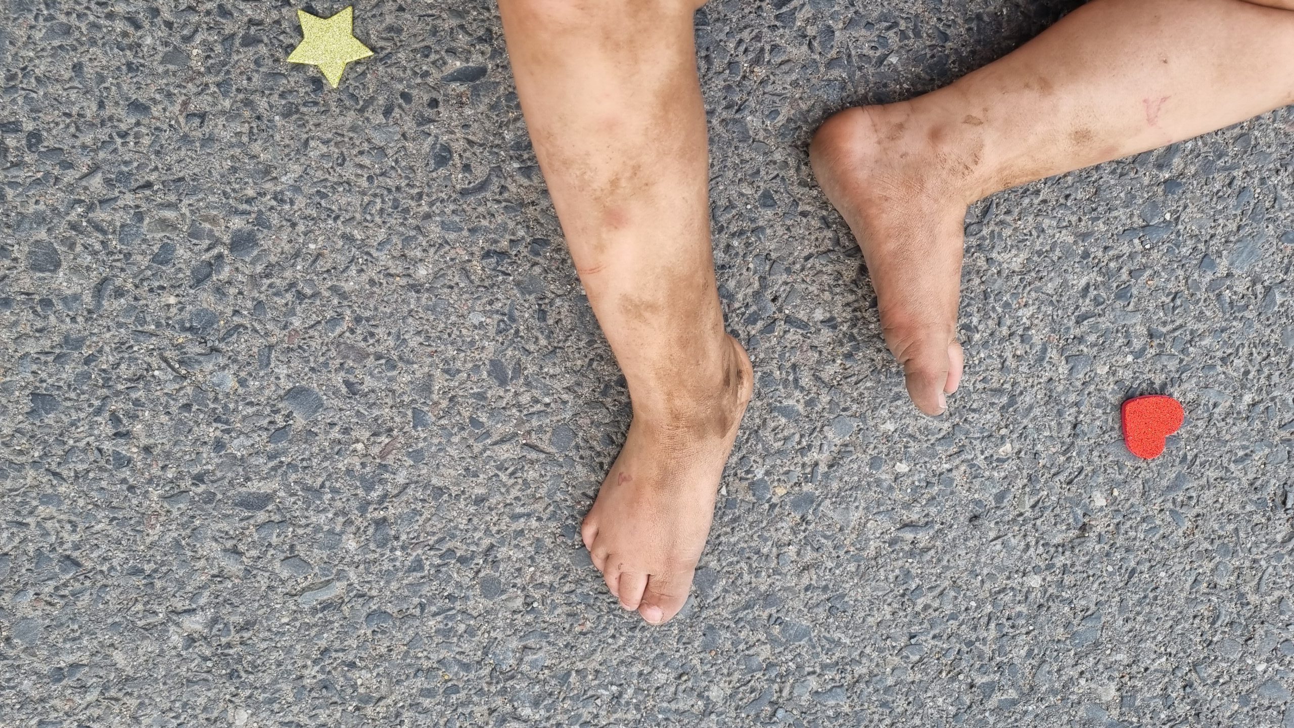 Schmutzige Beine eines Kindes und 2 Aufkleber
